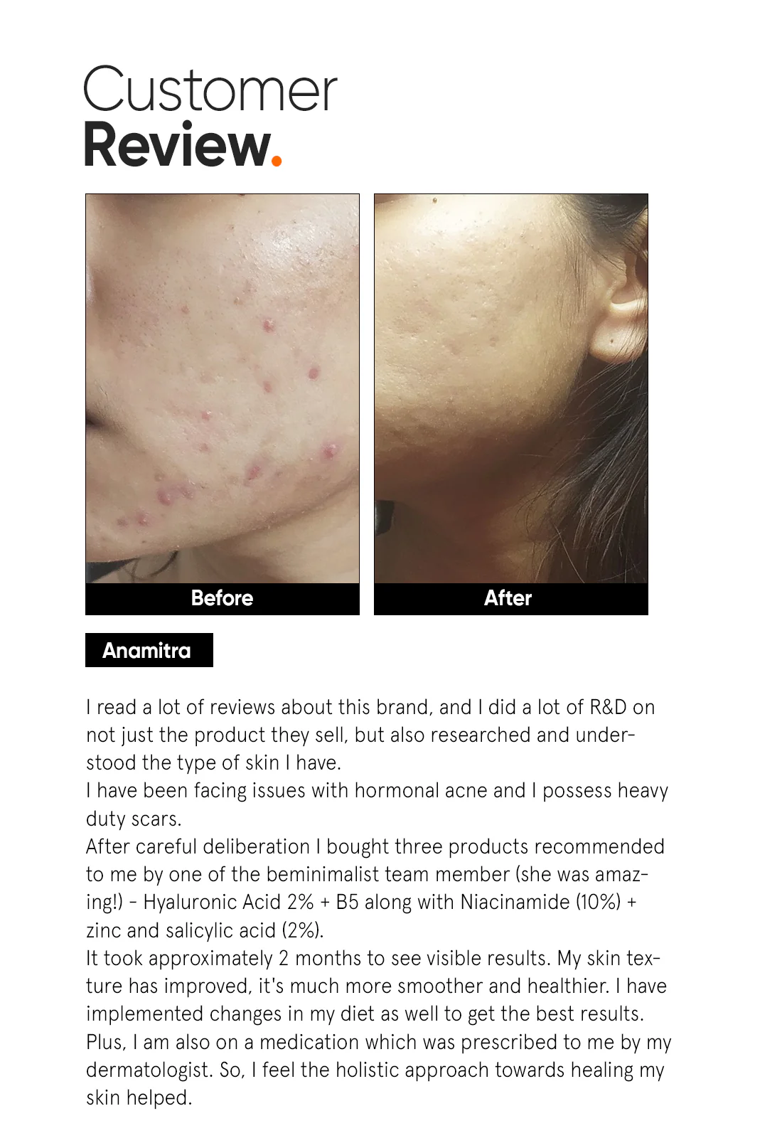 Hyaluronic + PGA 2% Face Serum - Image 5