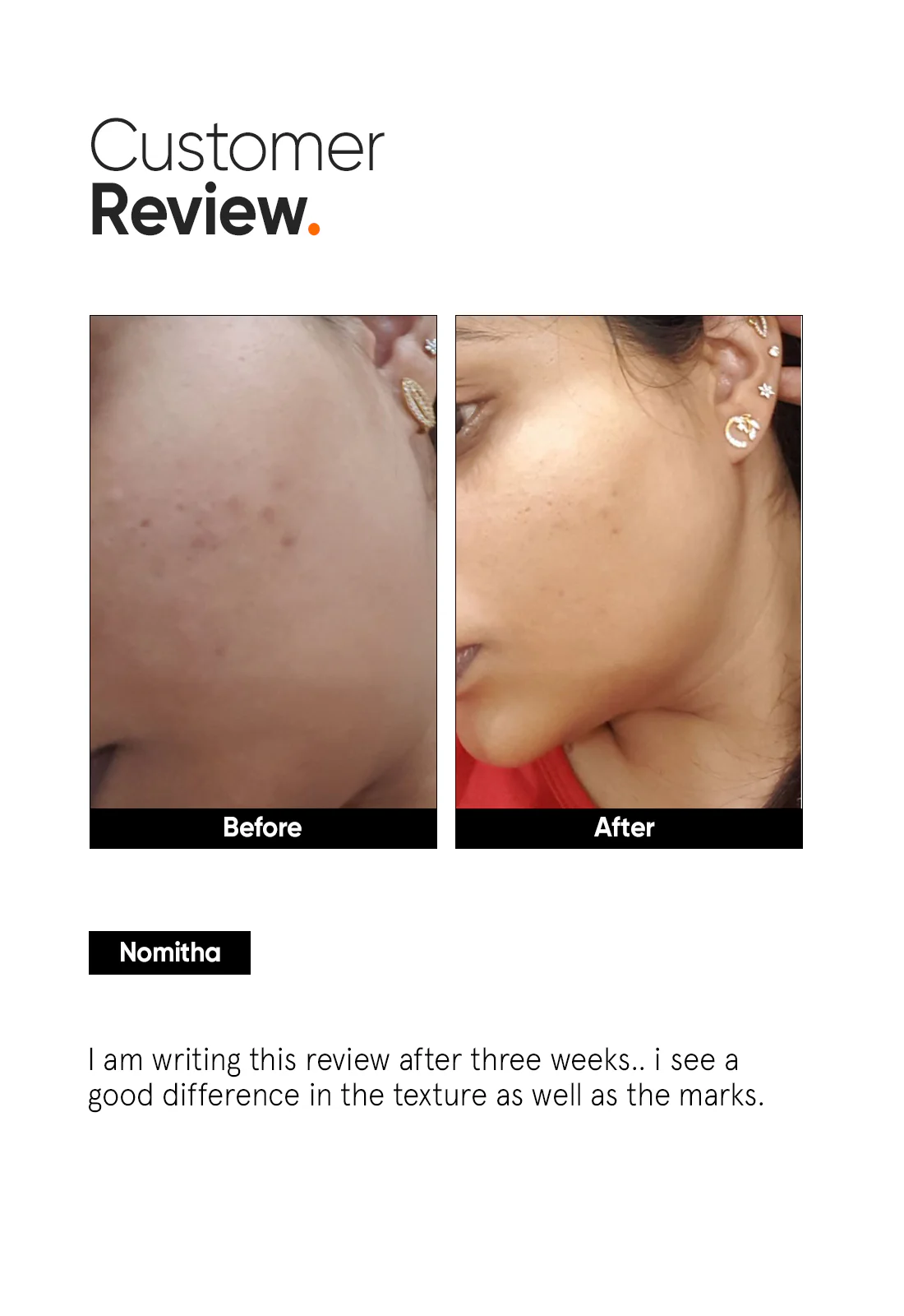 AHA PHA BHA 32% Face Peel - Image 5