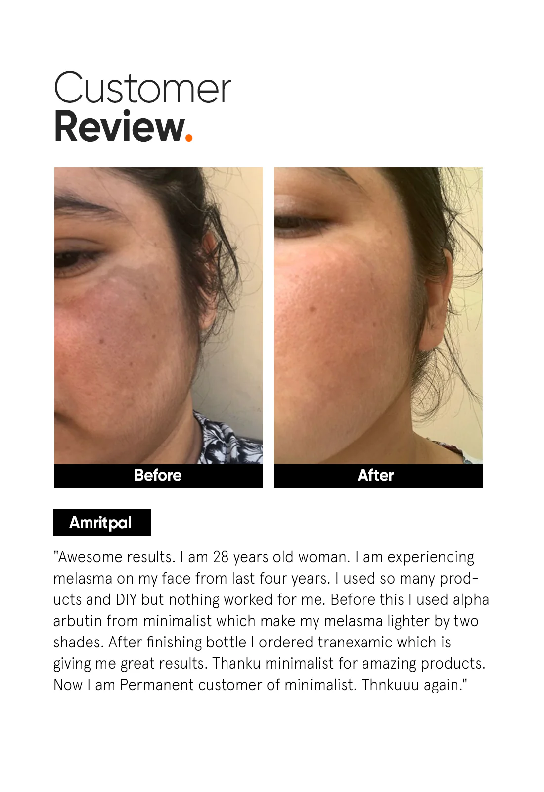 Tranexamic 3% Face Serum - Image 5